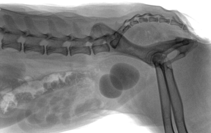 Urolitiasis